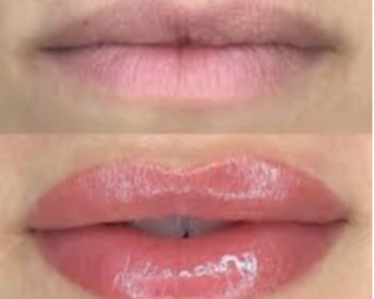 💋 Hidralips: Labios esplendidos e hidratados
