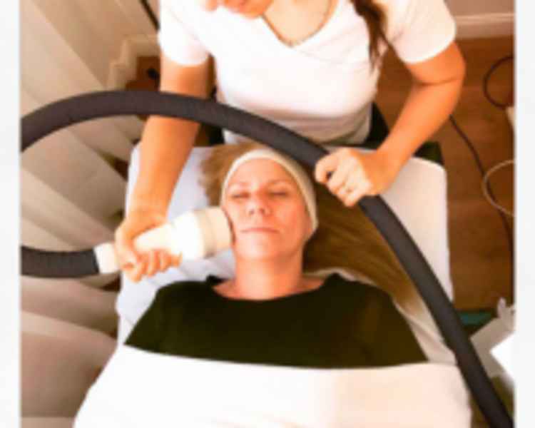 Sesión de tensado facial con Crioradiofrecuencia