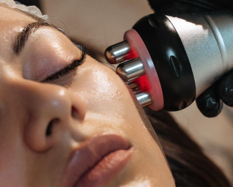 Limpieza Facial+ Radiofrecuencia 