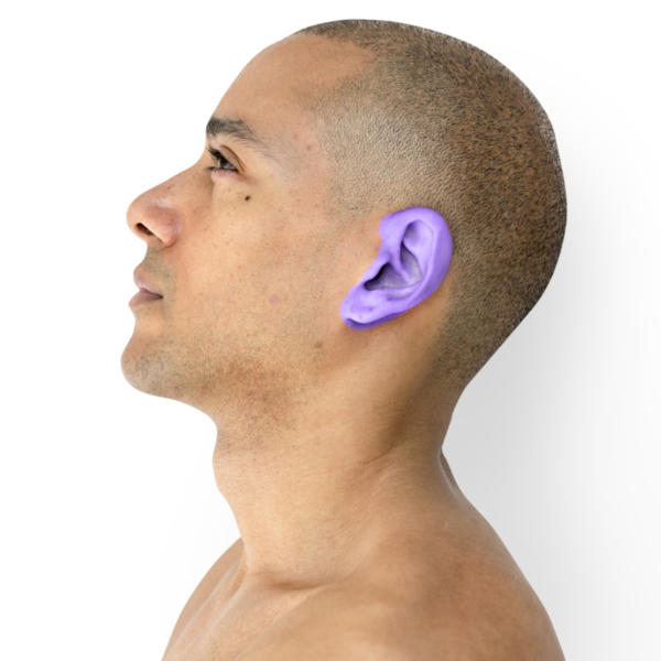 Ears Wax / Cera en Orejas 