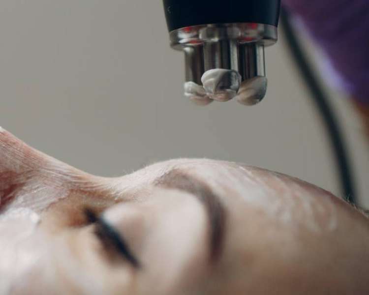 Higiene Facial Profunda + Radiofrecuencia