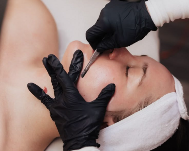 Higiene Facial Profunda + Peeling + Dermaplaning