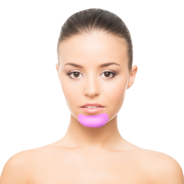 Chin / Barbilla (1 Session)