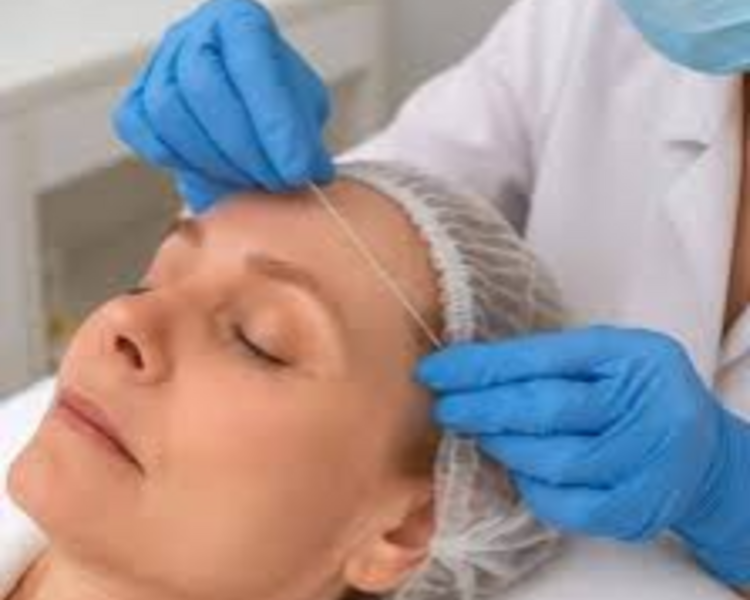 HILOS DE COLAGENO REABSORBIBLES 