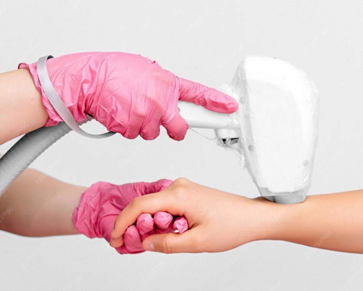 DEPILACIÓN LÁSER MANOS