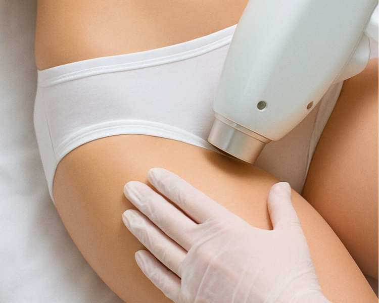 DEPILACIÓN LÁSER BIKINI