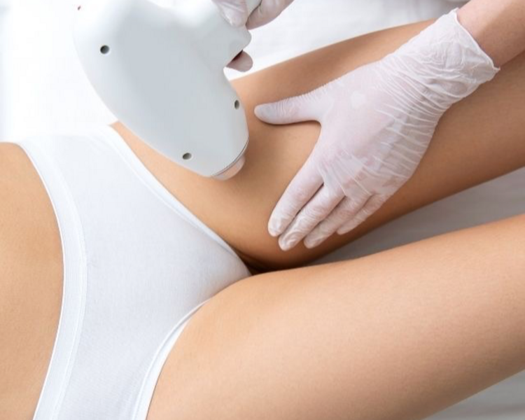 DEPILACIÓN LÁSER ENTRE PIERNAS