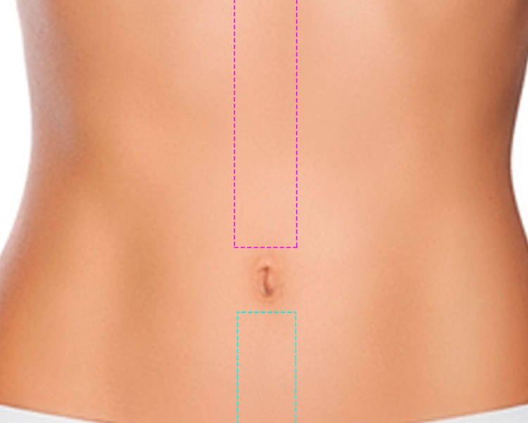 DEPILACIÓN LÁSER LÍNEA DEL ABDOMEN 