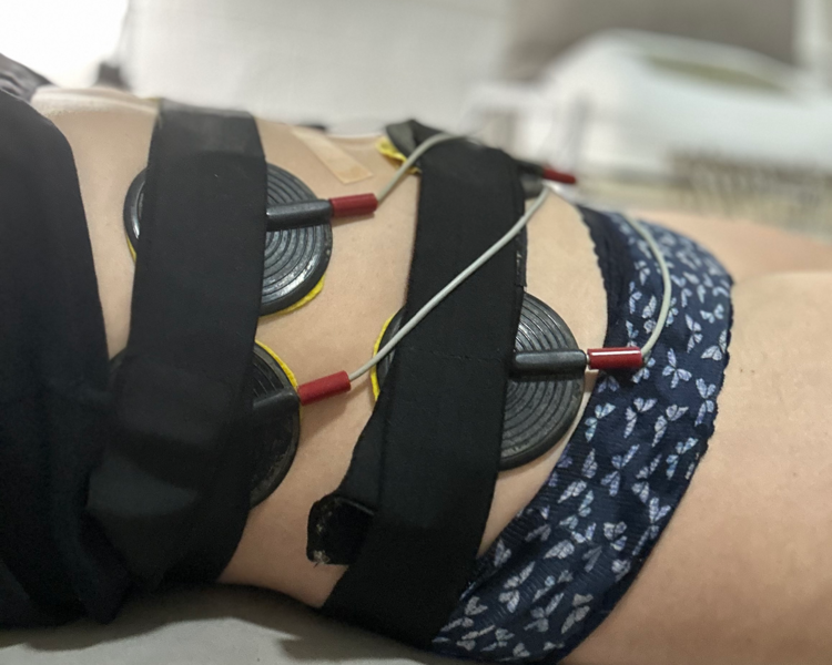 1 sesión FIRM&LIFT (reafirmar + tonificar): Radiofrecuencia + Electrodos en 1 zona