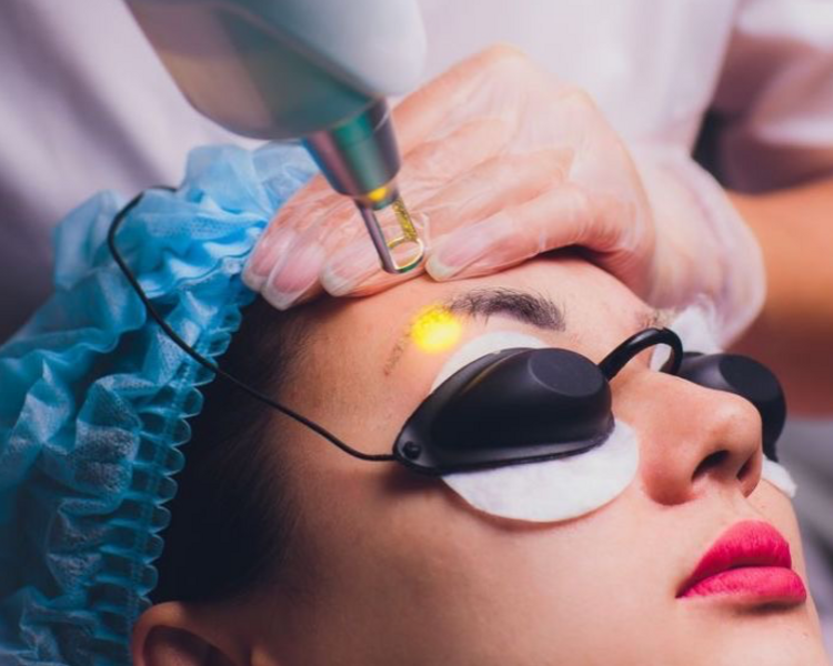 ELIMINACIÓN CEJA TATUAJE 