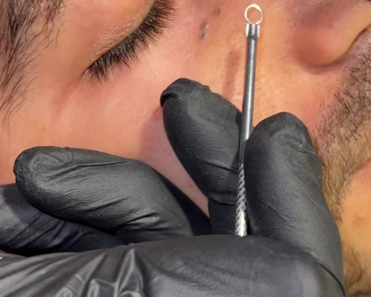 🌑 Limpieza Anti-Comedones Sakura 💮