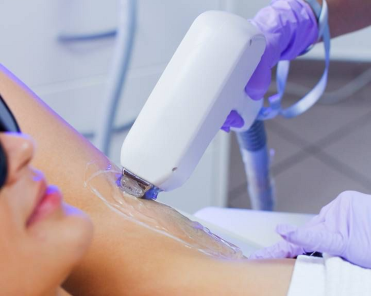 Depilación Láser L+M