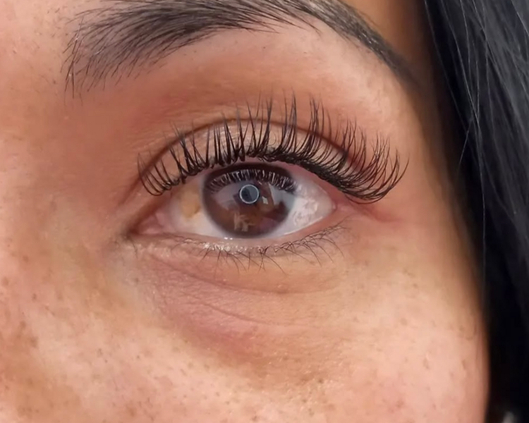 Extensiones clasicas