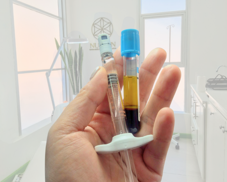 Plasma Capilar + PDNR (semen de salmón) (4 sesiones)