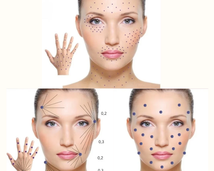 Plasma rico en plaquetas facial + Polinucleótidos