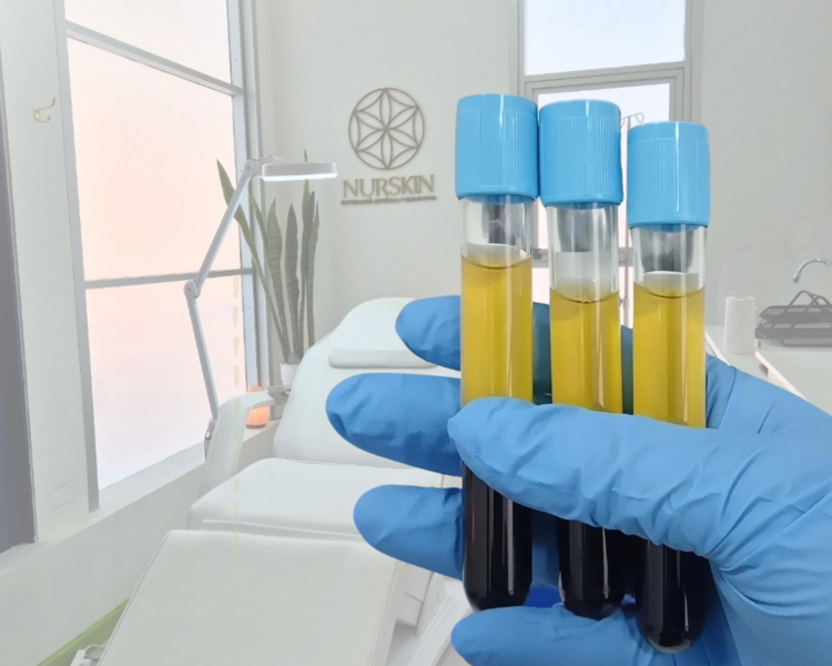 Plasma rico en plaquetas Facial (4 sesiones)