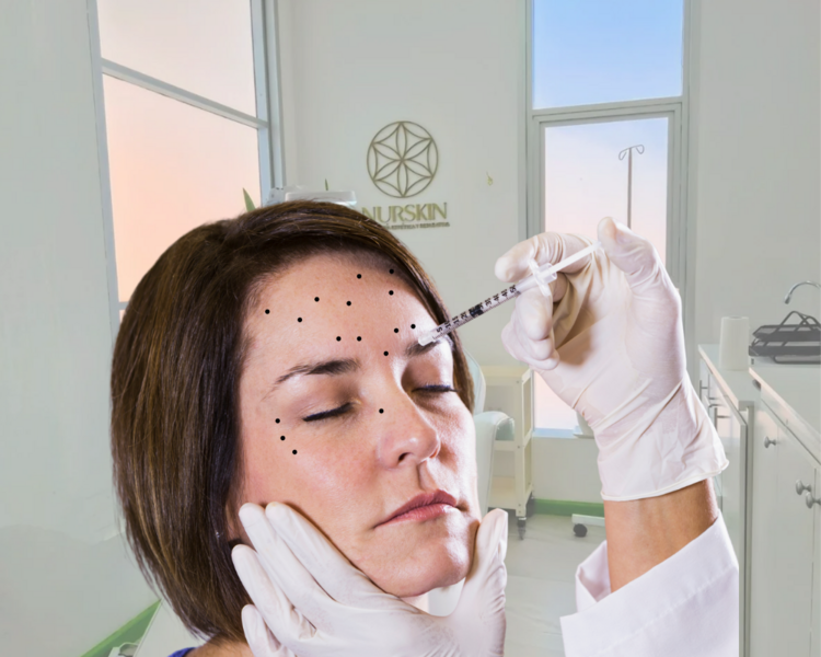 Toxina Botulinica Tercio superior (50 UI)