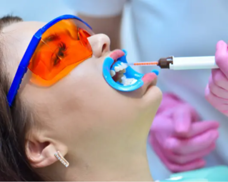 Profilaxis + Limpieza profesional + Blanqueamiento (3 aplicaciones) + Flúor + Irrigador