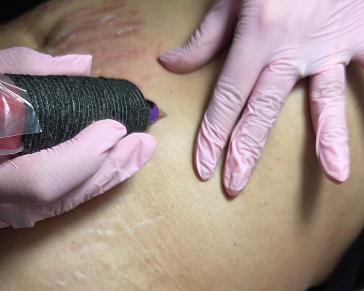 CAMUFLAJE DE ESTRIAS VALOR A CONSULTAR