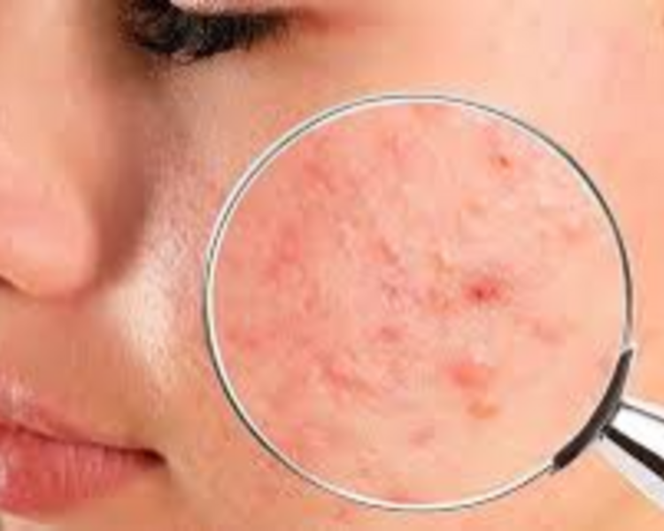 Consulta Dermatología Facial Avanzada con IA 👨🏽⚕️🔎🔬