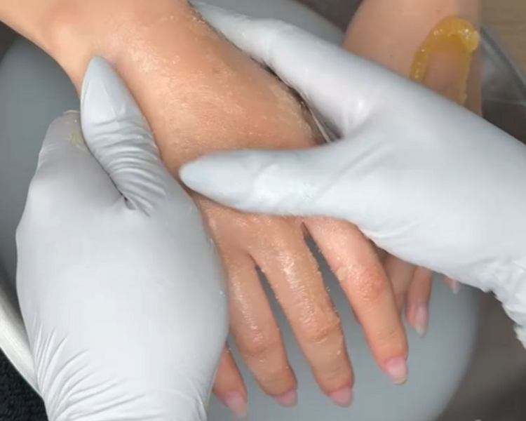 	 Exfoliación de MANOS