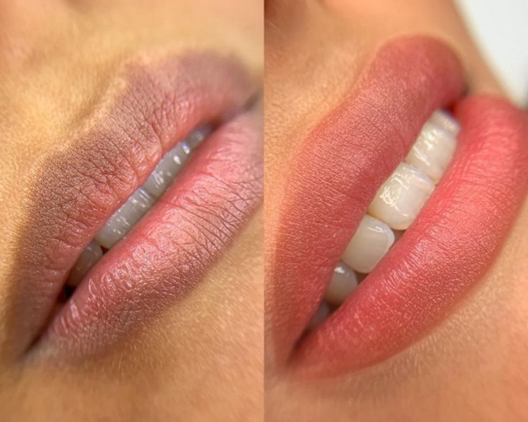 Neutralización - Para labios oscuros o con manchas