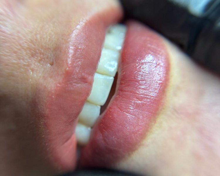 Soft Lips (Micropigmentación de labios) 