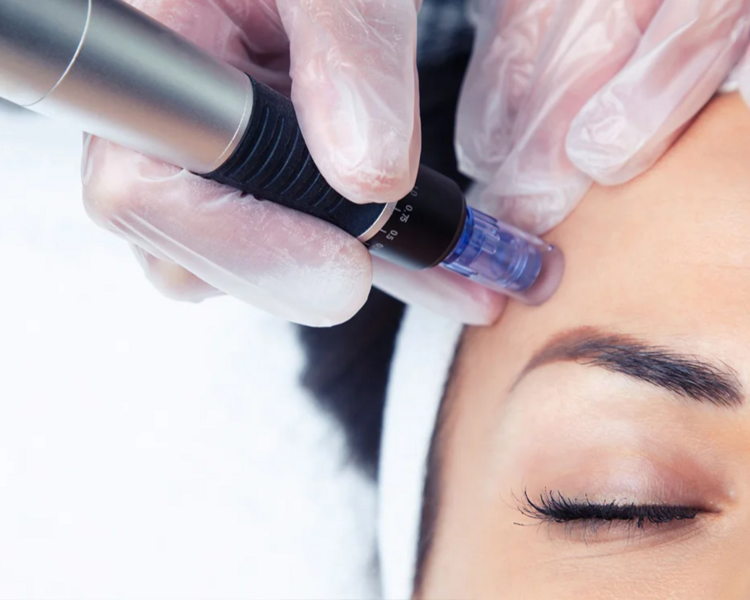 Dermapen médico + Dermaplaning