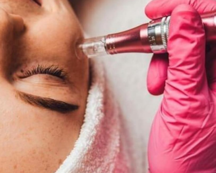 SHOCK DE COLAGENO + MICRONEEDLING