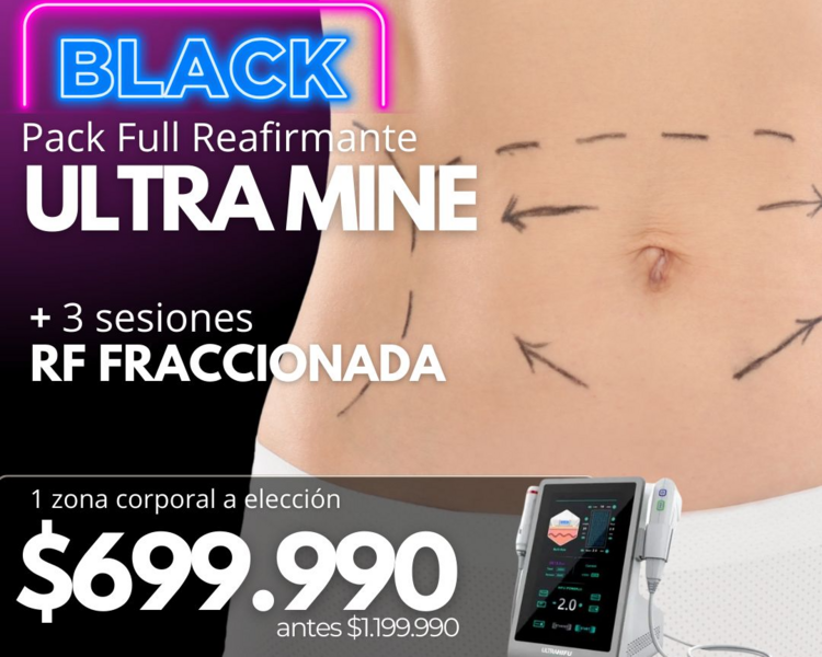 BLACK 1 SESIÓN ULTRAMINE + 3 SESIONES RF FRACCIONADA 