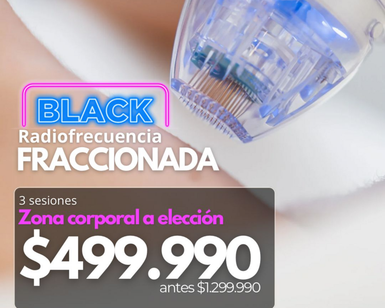 3 SESIONES RADIOFRECUENCIA FRACCIONADA 1 ZONA CORPORAL 
