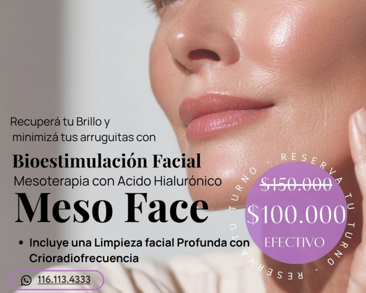Meso Face: Limpieza facial con Crioradiofrecuencia + Mesoterapia Facial con Hialurónico