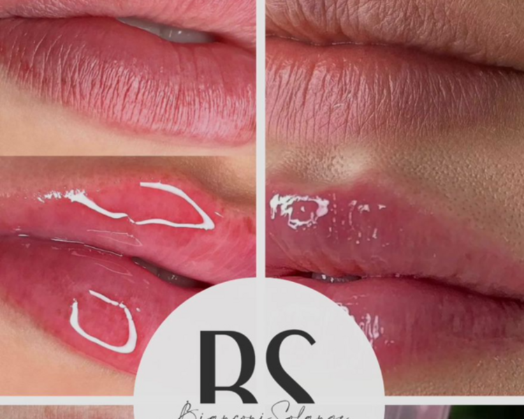 HIDRA LIPS👄✨(PROMO EFECTIVO)