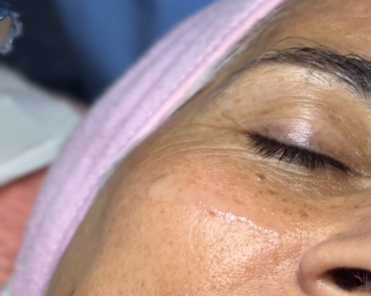 DermaPiel Básica (Limpieza Facial Básica) 