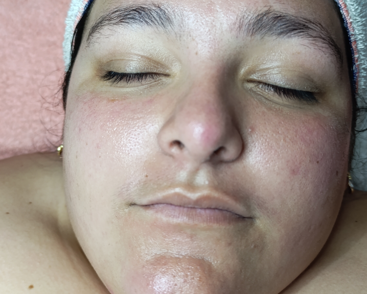 Diagnóstico Facial 