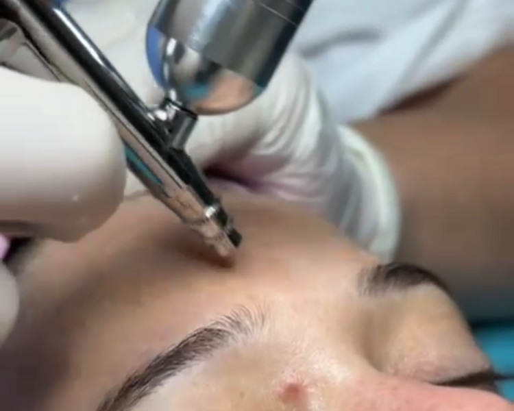 HydraGlow (Piel con Glow)