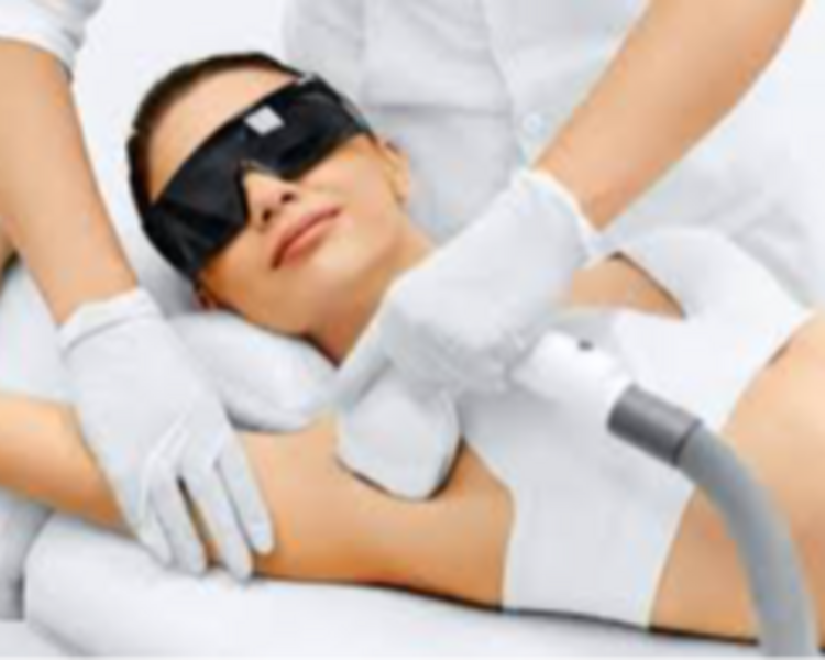 DEPILACION LASER AXILAS 