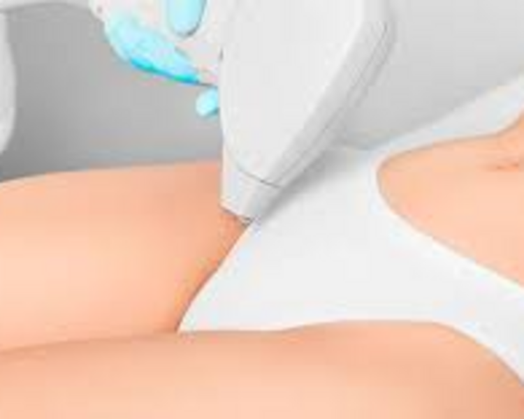 DEPILACION LASER BIKINI