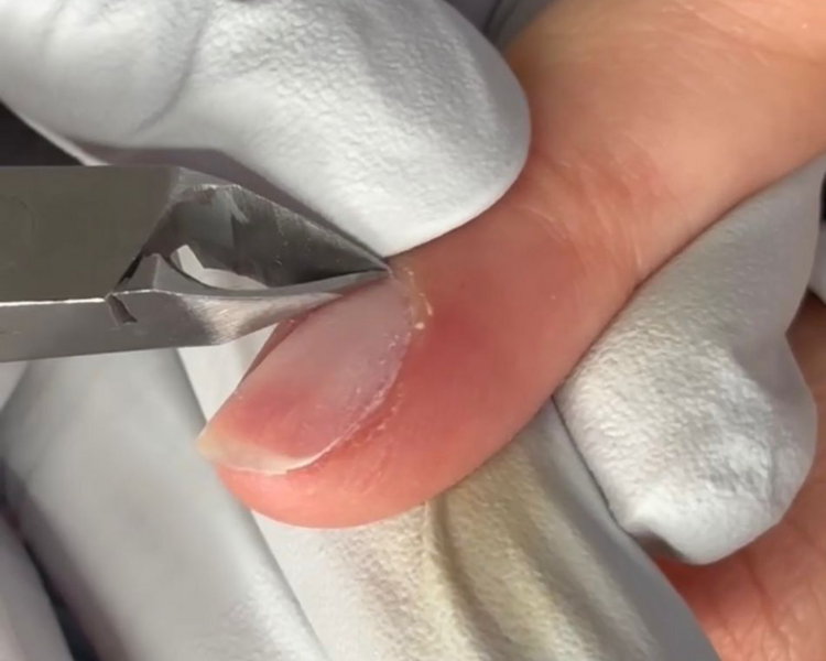 Paquete PLEXIGEL BUILDER TIP