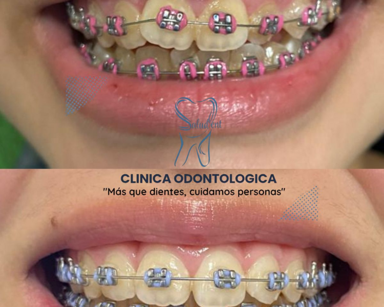 🦷 ¡Transforma tu sonrisa desde hoy!