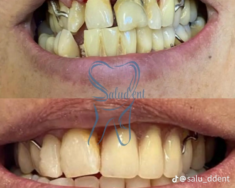 🦷 EVALUACIÓN Y PRESUPUESTO – COSTO $0