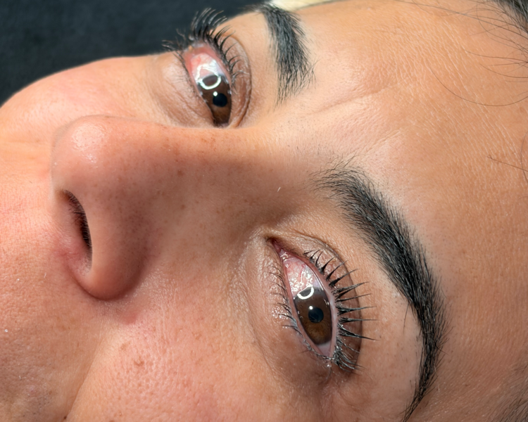 Lifting Coreano (K-Lifting)