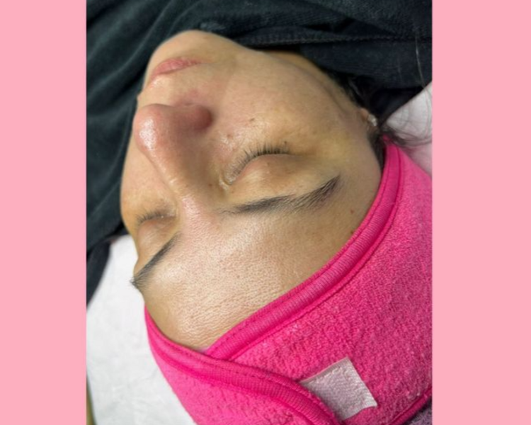 Limpieza Facial Básica 