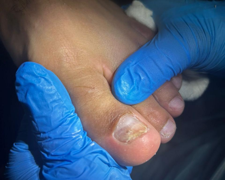 Atención Podológica Domiciliaria 