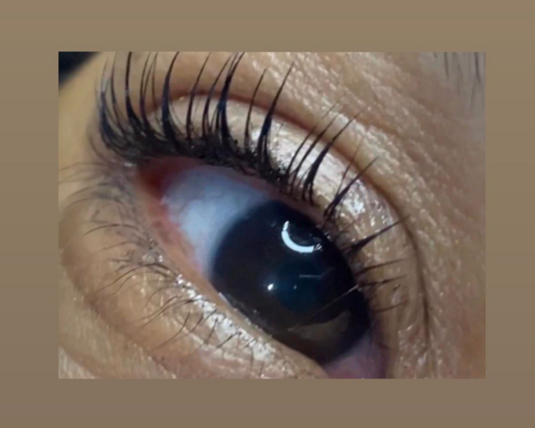 Lifting de Pestañas 