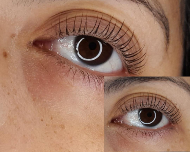 LIFTIING DE PESTAÑAS