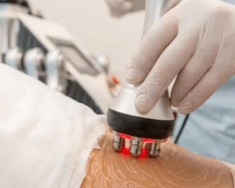 RADIOFRECUENCIA + DRENAJE LINFATICO