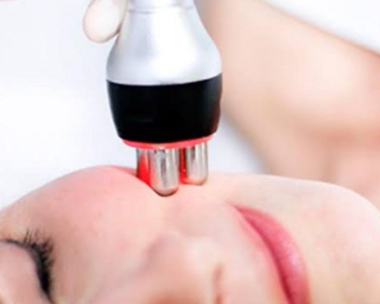 HIGIENE FACIAL+RADIOFRECUENCIA