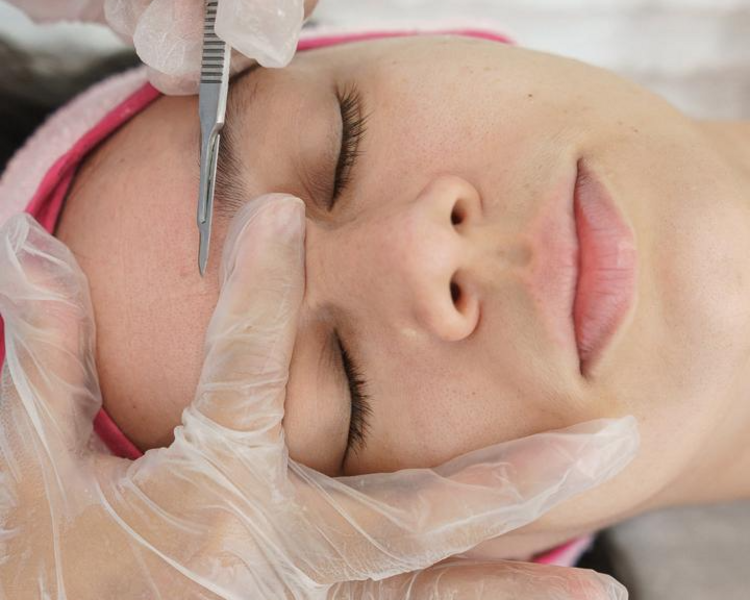 LIMPIEZA PROFUNDA + DERMAPLANING CON EXTRACCIONES