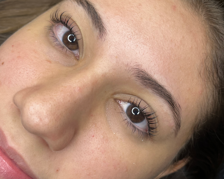 Lifting, color y botox